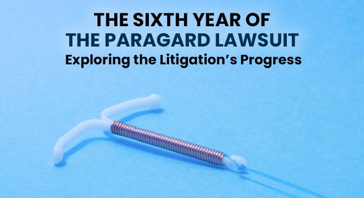 Paragard Lawsuit