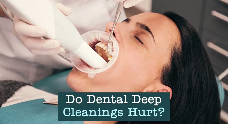 Dental Deep Cleanings