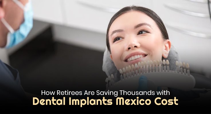 Dental Implants Mexico