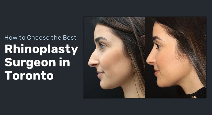 Best Rhinoplasty Surgeon