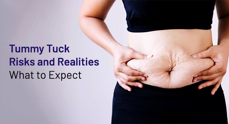 Tummy Tuck Risks