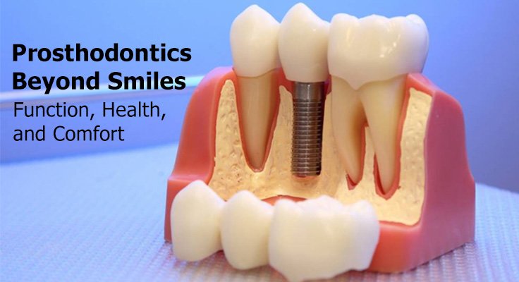 Prosthodontics Beyond Smiles