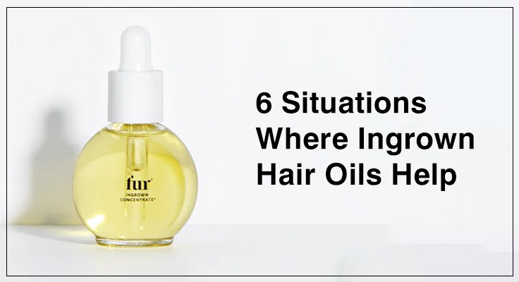 Ingrown Hair Oils