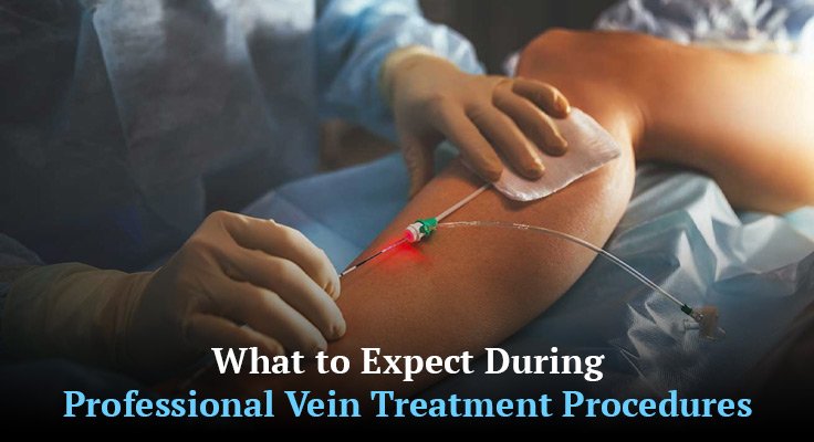 Professional Vein Treatment Procedures